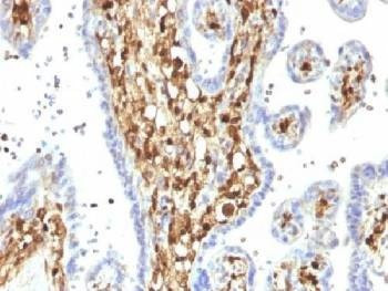 Anti-S100A4 / FSP1 Antibody