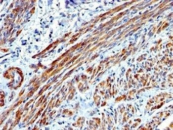 Anti-SMMHC Antibody
