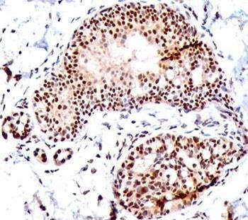 Anti-SUMO1 Antibody