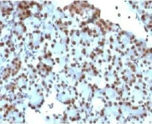 Anti-SUMO1 Antibody
