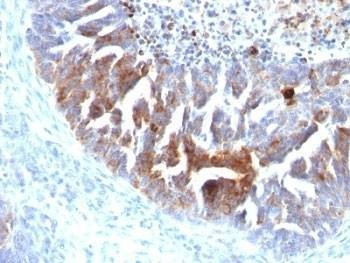 Anti-TAG-72 Antibody Cocktail