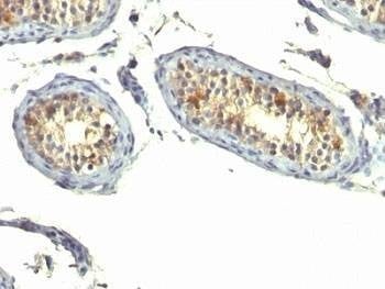 Anti-TGF-alpha Antibody