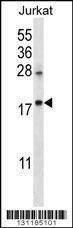 Anti-KRTAP25-1 (C-term) Antibody