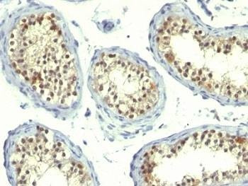 Anti-Thymidylate Synthase Antibody Cocktail