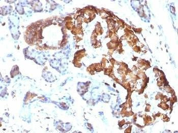 Anti-TNF-alpha Antibody