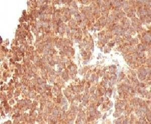 Anti-TOP1MT Antibody