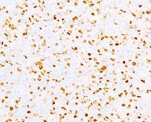 Anti-Topoisomerase II alpha Antibody