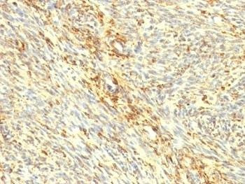 Anti-Transglutaminase 2 Antibody