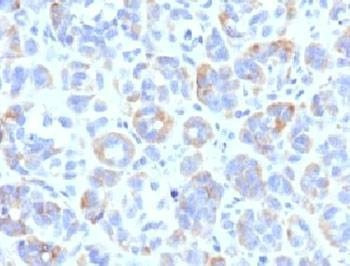Anti-TRP1 Antibody