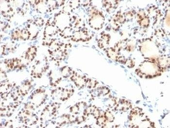 Anti-TTF1 Antibody