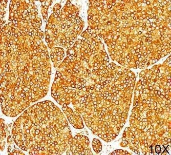 Anti-Tyrosinase Antibody