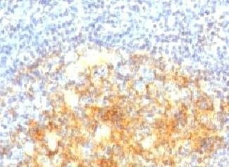 Anti-VCAM1 Antibody
