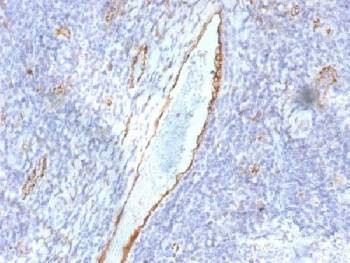 Anti-von Willebrand Factor / vWF Antibody