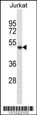 Anti-NBPF5 (C-term) Antibody