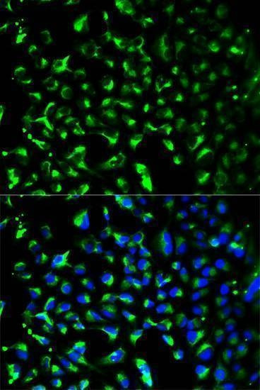 Anti-PHB Antibody