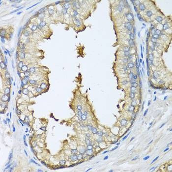 Anti-ATG5 Antibody