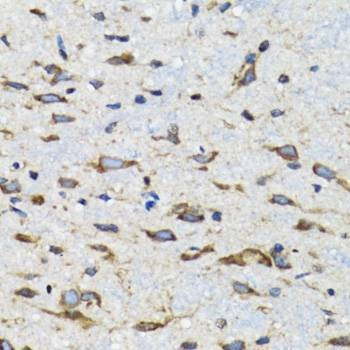 Anti-CDK1 Antibody