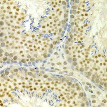 Anti-MAPK3 Antibody