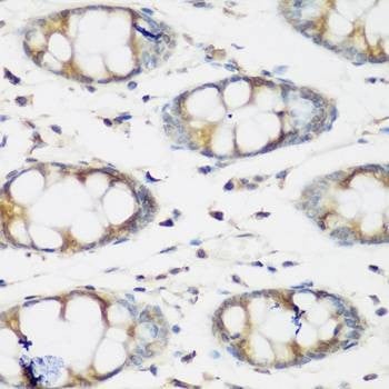 Anti-BMP2 Antibody