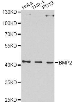 Anti-BMP2 Antibody