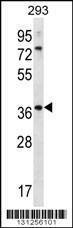 Anti-OR6X1 (C-term) Antibody