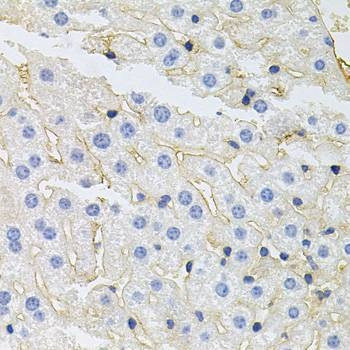 Anti-IGF1R Antibody