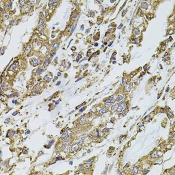 Anti-PIK3CA Antibody