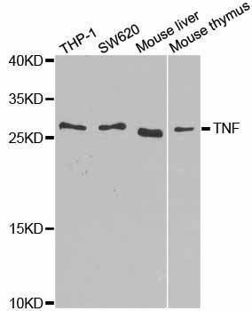 Anti-TNF Antibody