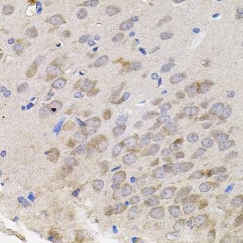 Anti-TNF Antibody