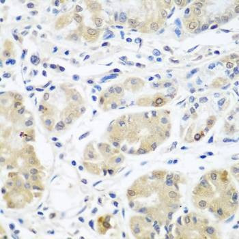 Anti-EIF3A Antibody