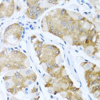 Anti-ACVR1C Antibody