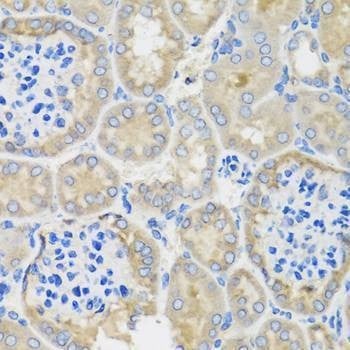 Anti-ACVR1C Antibody