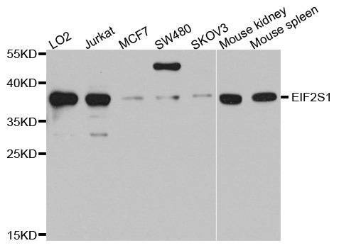 Anti-EIF2S1 Antibody