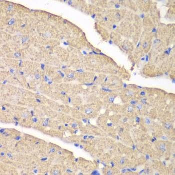 Anti-VDAC1 Antibody