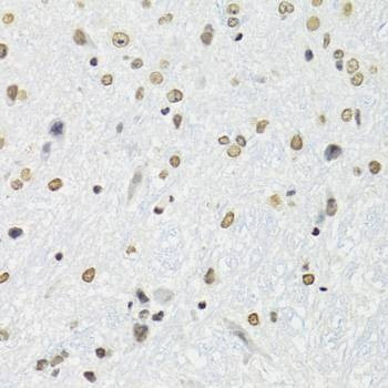 Anti-SFPQ Antibody