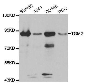 Anti-TGM2 Antibody