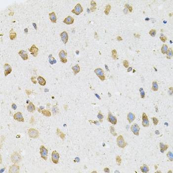 Anti-TGM2 Antibody