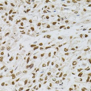 Anti-TGM2 Antibody