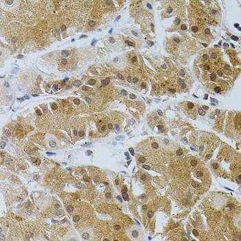 Anti-TGM2 Antibody