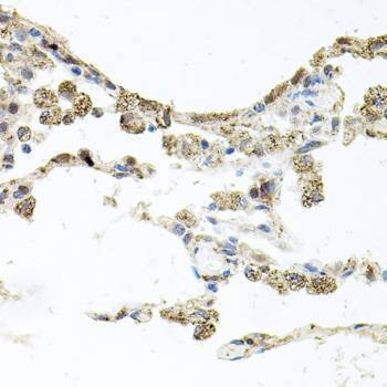Anti-PIK3CB Antibody