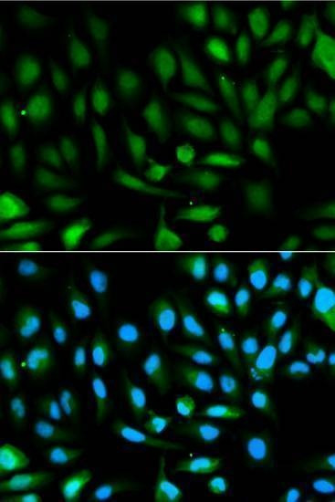 Anti-PARK7 Antibody