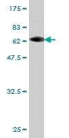 Anti-CAB39L Antibody