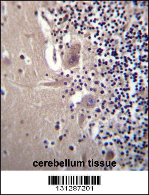 Anti-CRYBA1 (Center) Antibody