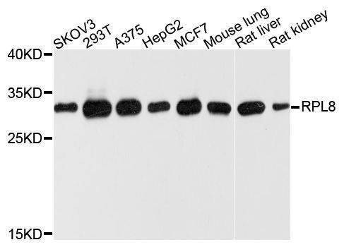Anti-RPL8 Antibody