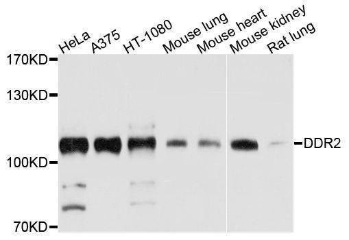 Anti-DDR2 Antibody