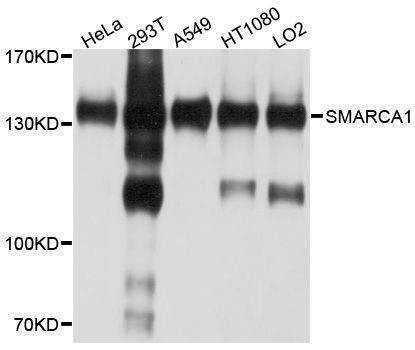 Anti-SMARCA1 Antibody