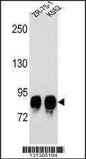 Anti-POMT1 (C-term) Antibody