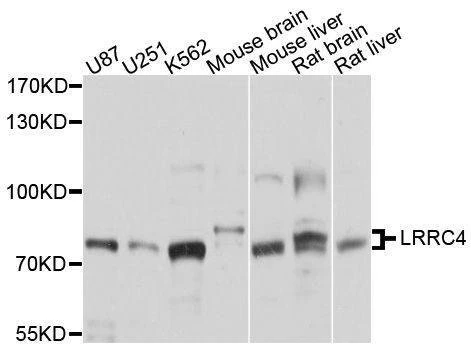 Anti-LRRC4 Antibody