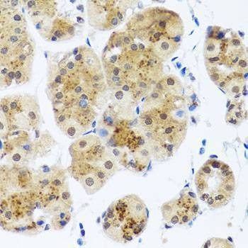Anti-RAD23B Antibody