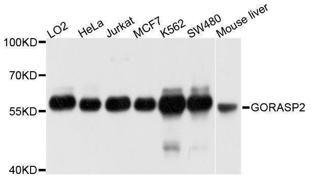 Anti-GORASP2 Antibody